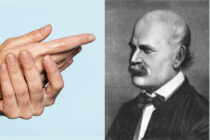 Igiene delle mani: COVID19 è stato più convincente di Ignác Fülöp Semmelweiss?